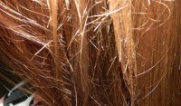Трихоклазия волос