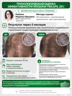Лосьон для роста волос Трикапил 25%, САМЫЙ МОЩНЫЙ в линейке Tricapil Лосьон для роста волос Трикапил 25%, САМЫЙ МОЩНЫЙ в линейке Tricapil