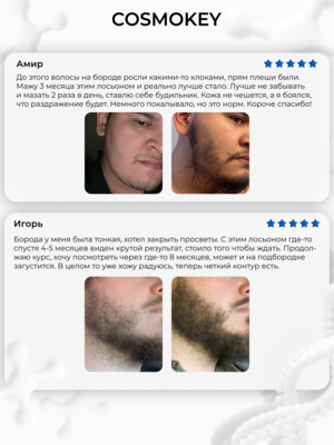 Cosmokey Tricapil FOR BEARD 5% Лосьон - активатор роста бороды, 50 мл 3 Купить Cosmokey Tricapil FOR BEARD 5% Лосьон - активатор роста бороды, 50 мл фото 3