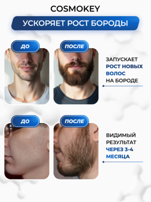 Cosmokey Tricapil FOR BEARD 5% Лосьон - активатор роста бороды, 50 мл 2 Купить Cosmokey Tricapil FOR BEARD 5% Лосьон - активатор роста бороды, 50 мл фото 2
