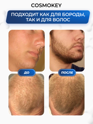 Cosmokey Tricapil FOR BEARD 5% Лосьон - активатор роста бороды, 50 мл 7 Купить Cosmokey Tricapil FOR BEARD 5% Лосьон - активатор роста бороды, 50 мл фото 7