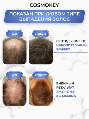 Купить Cosmokey Tricapil 5% Лосьон - активатор роста волос с тройным пептидным комплексом, 50 мл фото 1