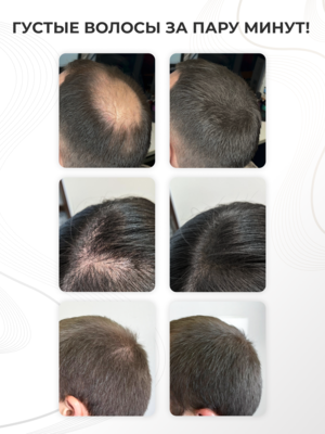 Cosmokey / Космокей Загуститель-камуфляж для волос, средний блонд (med blonde), 12 г 1 Купить Cosmokey / Космокей Загуститель-камуфляж для волос, средний блонд (med blonde), 12 г фото 1