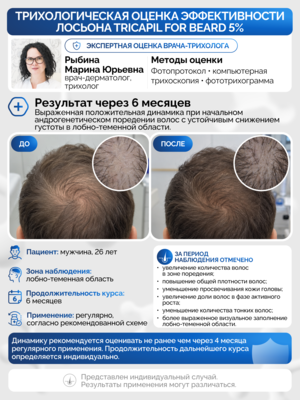 Лосьон для роста и укрепления волос Tricapil 5% for Beard, 6 флаконов 2 Купить Лосьон для роста и укрепления волос Tricapil 5% for Beard, 6 флаконов фото 2