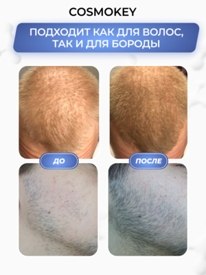 Cosmokey Tricapil 5% Лосьон - активатор роста волос с тройным пептидным комплексом, 50 мл + мезороллер 2 Купить Cosmokey Tricapil 5% Лосьон - активатор роста волос с тройным пептидным комплексом, 50 мл + мезороллер фото 2