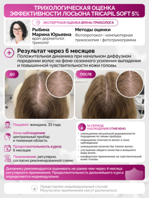 Купить Лосьон для роста волос Трикапил 5% для чувствительной кожи головы фото 2