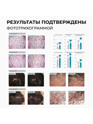 Купить Cosmokey / Космокей Шампунь с пептидами для стимуляции роста волос, 150 мл фото 8