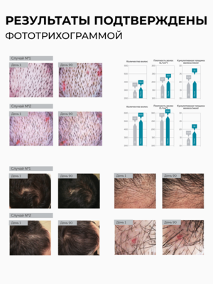 Cosmokey / Космокей Пептидный лосьон - активатор роста волос Peptide Pro Line, 50 мл 10 Купить Cosmokey / Космокей Пептидный лосьон - активатор роста волос Peptide Pro Line, 50 мл фото 10