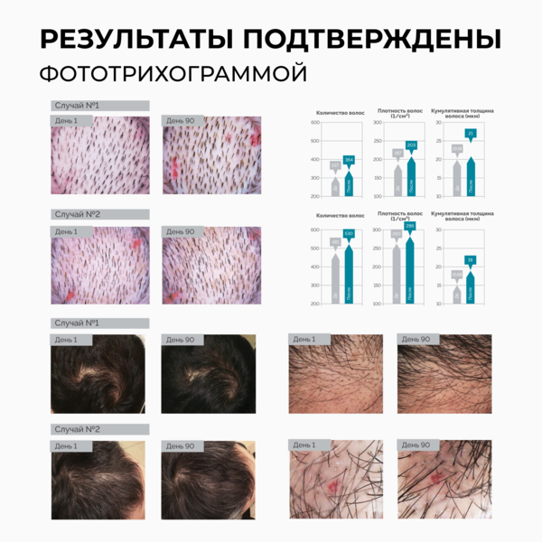 Купить Cosmokey / Космокей Пептидный лосьон - активатор роста волос Peptide Pro Line, 50 мл фото 10