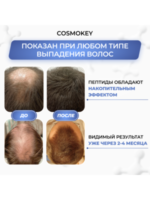 Cosmokey Tricapil 5% Лосьон - активатор роста волос с тройным пептидным комплексом, 50 мл + мезороллер 1 Купить Cosmokey Tricapil 5% Лосьон - активатор роста волос с тройным пептидным комплексом, 50 мл + мезороллер фото 1
