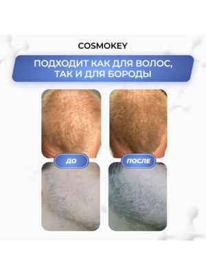 Cosmokey Tricapil 5% Лосьон - активатор роста волос с тройным пептидным комплексом, 50 мл + мезороллер 2 Купить Cosmokey Tricapil 5% Лосьон - активатор роста волос с тройным пептидным комплексом, 50 мл + мезороллер фото 2