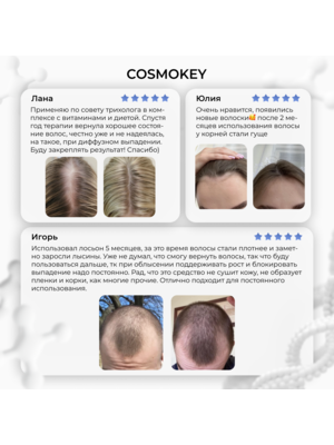 Cosmokey Tricapil 5% Лосьон - активатор роста волос с тройным пептидным комплексом, 50 мл + мезороллер 9 Купить Cosmokey Tricapil 5% Лосьон - активатор роста волос с тройным пептидным комплексом, 50 мл + мезороллер фото 9