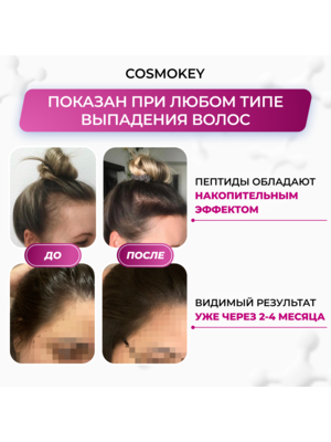 Cosmokey Tricapil 5% SOFT+ Лосьон - активатор роста волос для чувствительной кожи головы, 50 мл + мезороллер 1 Купить Cosmokey Tricapil 5% SOFT+ Лосьон - активатор роста волос для чувствительной кожи головы, 50 мл + мезороллер фото 1