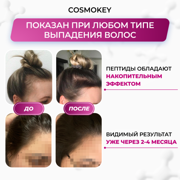 Купить Cosmokey Tricapil 5% SOFT+ Лосьон - активатор роста волос для чувствительной кожи головы, 50 мл, набор 3 уп. фото 1