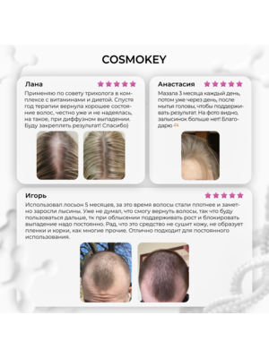 Cosmokey Tricapil 5% SOFT+ Лосьон - активатор роста волос для чувствительной кожи головы, 50 мл + мезороллер 9 Купить Cosmokey Tricapil 5% SOFT+ Лосьон - активатор роста волос для чувствительной кожи головы, 50 мл + мезороллер фото 9