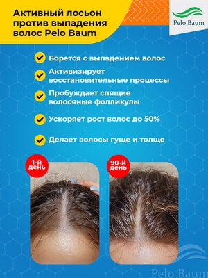 Лосьон-активатор роста волос Pelo Baum на 1 месяц 1 Купить Лосьон-активатор роста волос Pelo Baum на 1 месяц фото 1