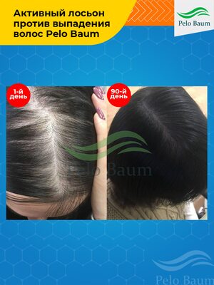Лосьон-активатор роста волос Pelo Baum на 1 месяц 5 Купить Лосьон-активатор роста волос Pelo Baum на 1 месяц фото 5