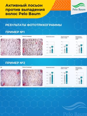Лосьон-активатор роста волос Pelo Baum на 1 месяц 8 Купить Лосьон-активатор роста волос Pelo Baum на 1 месяц фото 8