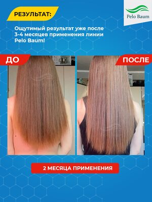 Лосьон-активатор роста волос Pelo Baum на 1 месяц 9 Купить Лосьон-активатор роста волос Pelo Baum на 1 месяц фото 9