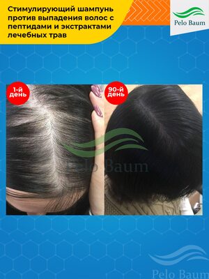 Восстанавливающий Шампунь Pelo Baum для стимуляции роста волос 6 Купить Восстанавливающий Шампунь Pelo Baum для стимуляции роста волос фото 6