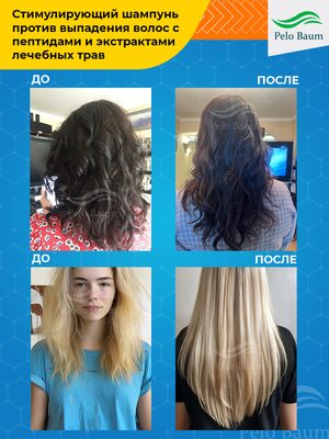 Восстанавливающий Шампунь Pelo Baum для стимуляции роста волос 7 Купить Восстанавливающий Шампунь Pelo Baum для стимуляции роста волос фото 7
