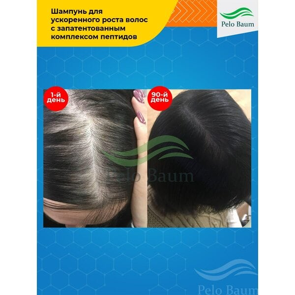 Купить Восстанавливающий Шампунь Pelo Baum для стимуляции роста волос фото 7