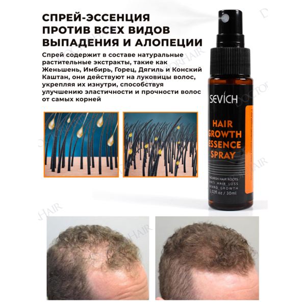 Купить Sevich Спрей - эссенция для активации роста волос с Имбирем, Женьшенем и Конским каштаном 30 мл фото 1