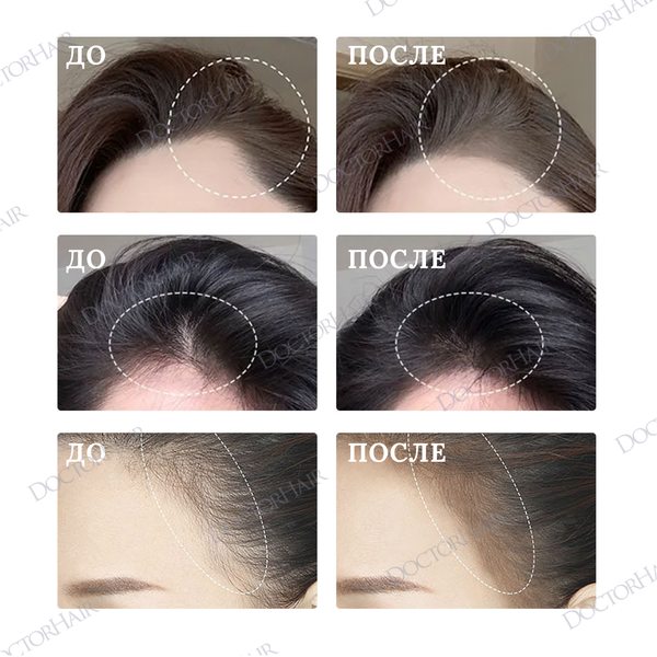 Купить Sevich Маскирующий стик с пудрой для камуфляжа линии роста волос и пробора, 2 г, средне-коричневый фото 3
