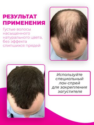 Sevich Загуститель для волос темно-коричневый, 100 гр (рефил) 3 Купить Sevich Загуститель для волос темно-коричневый, 100 гр (рефил) фото 3