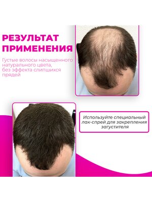 Купить Загуститель для волос Sevich (светло-коричневый), 25 гр фото 2
