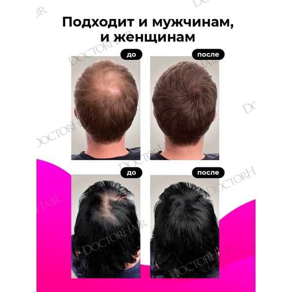 Купить Загуститель для волос Sevich (средне-коричневый), 12 гр фото 5