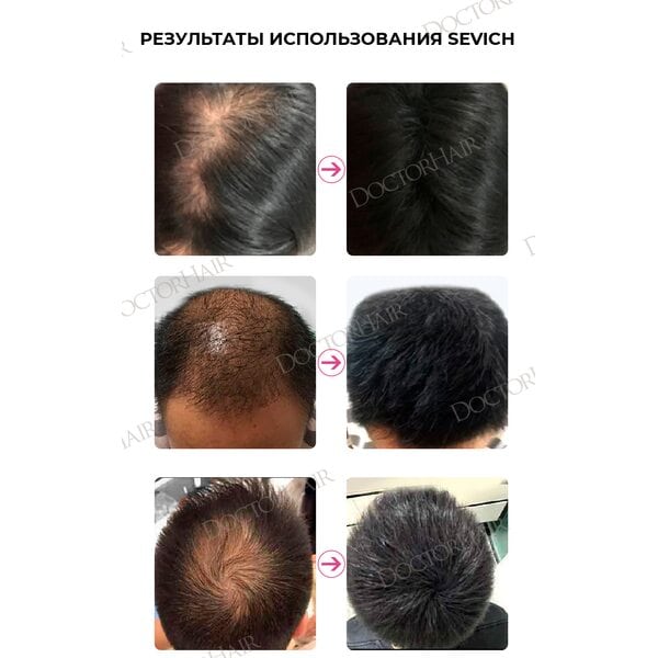 Купить Загуститель для волос средне-коричневый Sevich, 25 гр (рефил) фото 3