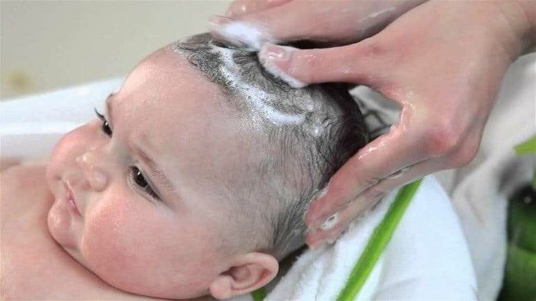 Правила по уходу за волосами ребенка, чтобы избежать появления перхоти
