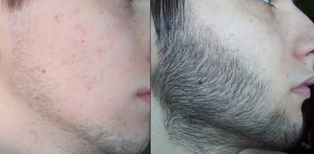 борода до и после